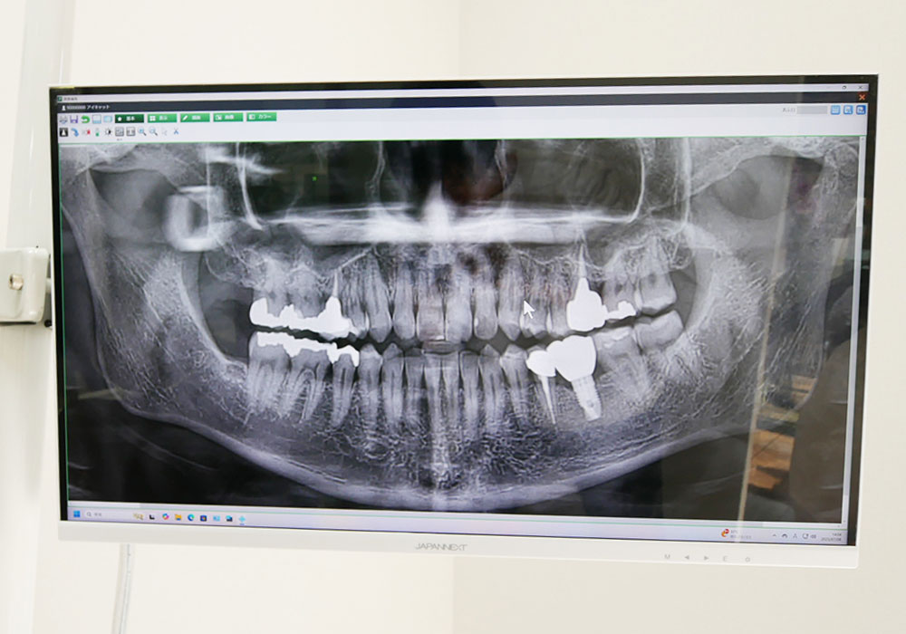 説明用モニター